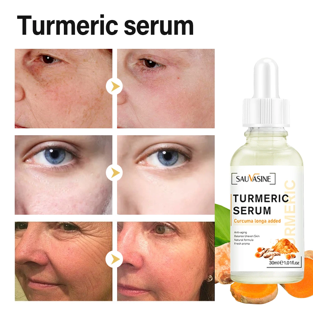 Turmeric Face Serum Whitening Dark Spot Remover Acne Scar Bright Skin Corrector Facial Essence Bright Skin 30ML Dropshipping